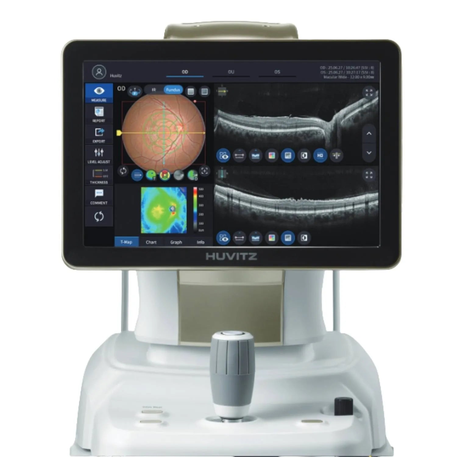 Imagen de la tomografía de coherencia óptica OCTavius de Beracah Médica con cámara de fondo para estudios oftalmológicos.