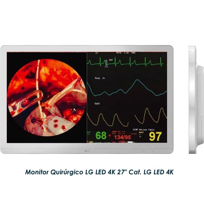 Complete endoscopy tower Eluxeo Lite 6000 system with 9 components Cat. FUJ-TORREEND Brand Fujifilm